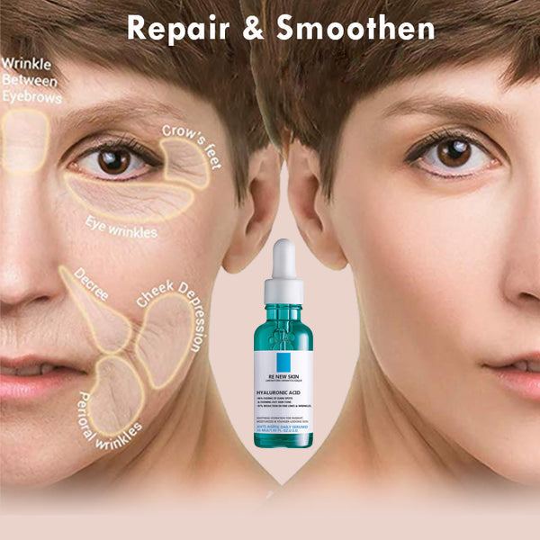 🔥RENEWSKIN™ Best Anti Aging Serum🔥Aging Serum For Remove 97% Deep Wrinkles & Dark Spots